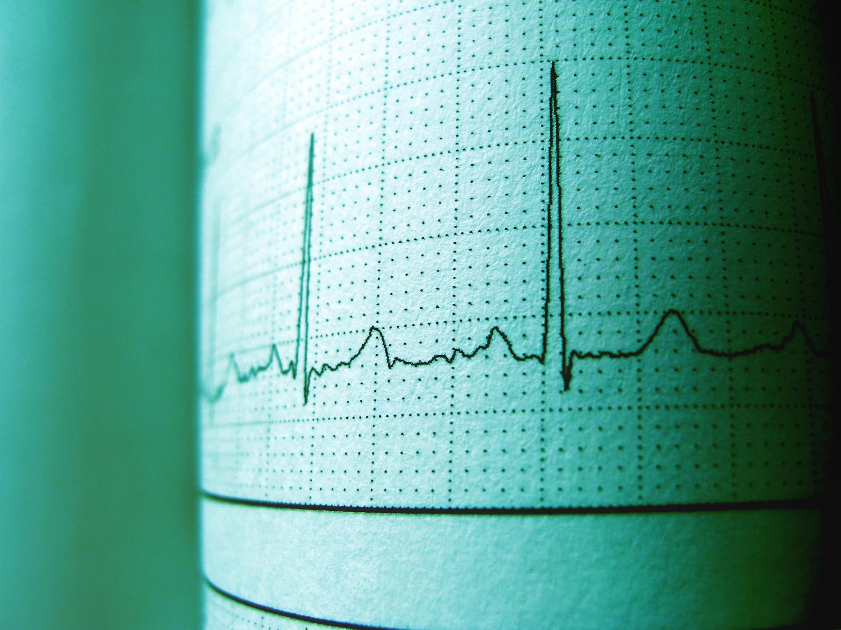The Hidden Rhythms of Your Heart: What Variability Reveals About Health