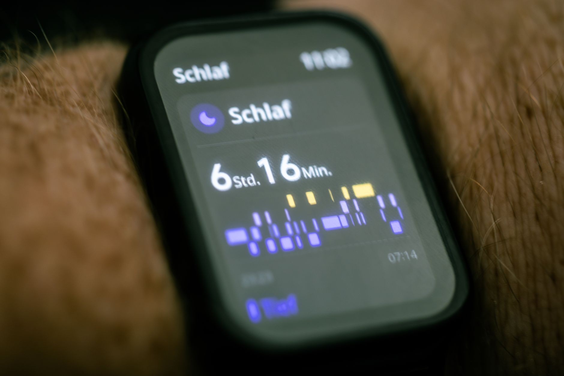 SensorFM: Revolutionising Wearable Health Data Interpretation