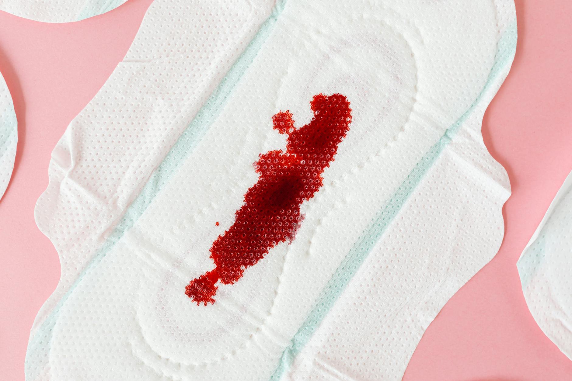 Supreme Court: Ensure Sanitary Napkins and Toilets in Schools