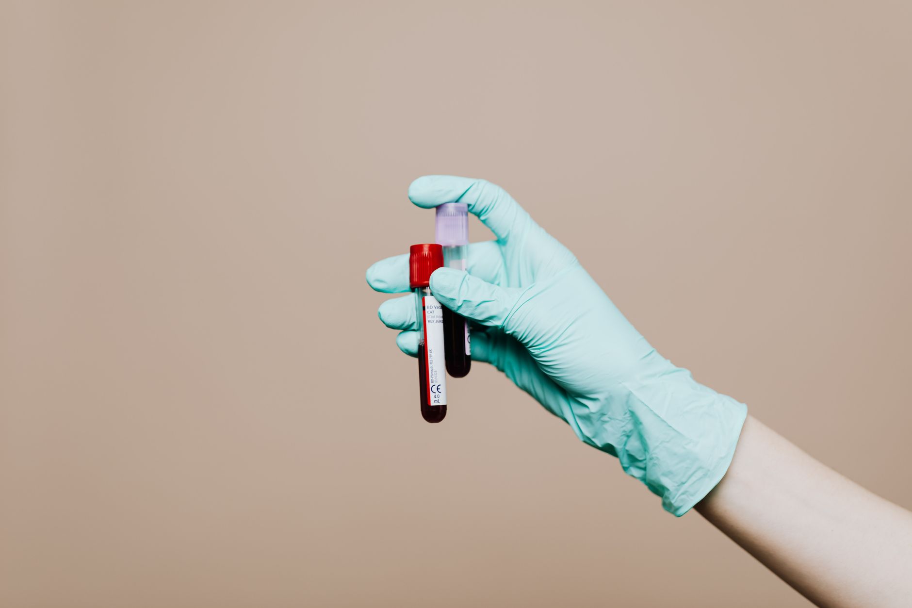 The Silent Signals: What Your ALT Level Says About Liver Health
