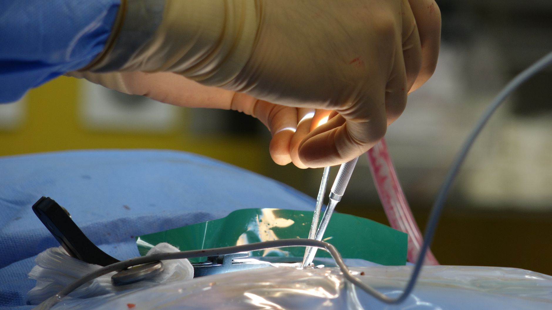 Breakthrough Brain Implant Restores Movement to Paralysed Man's Hands