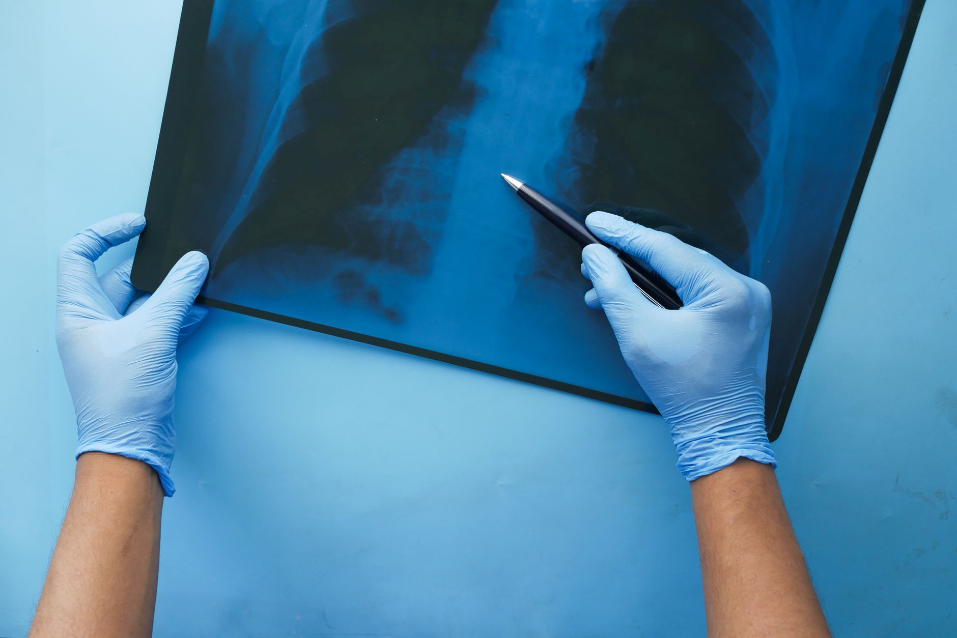 Harnessing AI to Revolutionise Disease Detection and Treatment