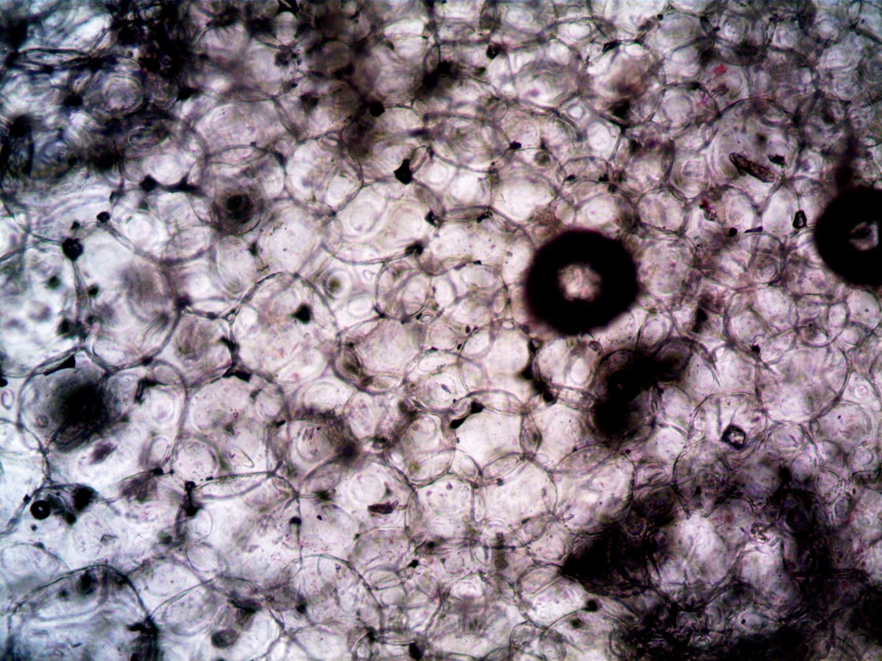 New Discovery Unravels Liver's Stubborn Healing Mystery Post-Alcohol
