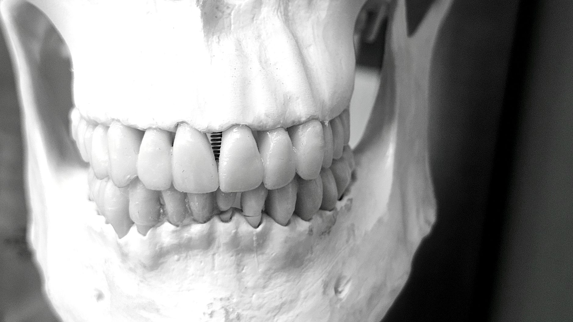 Scientists Edge Closer to Regrowing Human Teeth