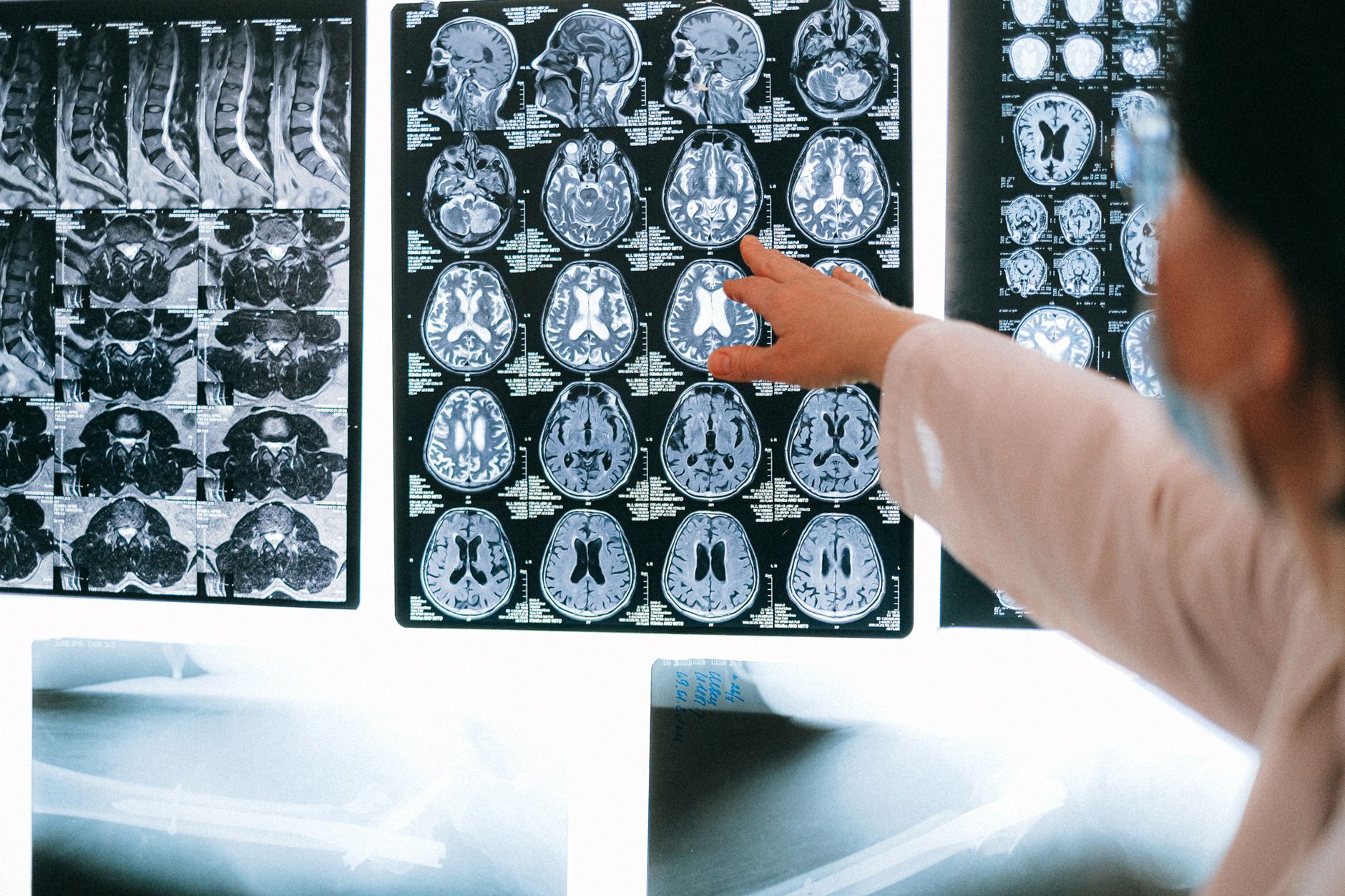 Unlocking the Brain: Advancements in Generalist Neuroimaging