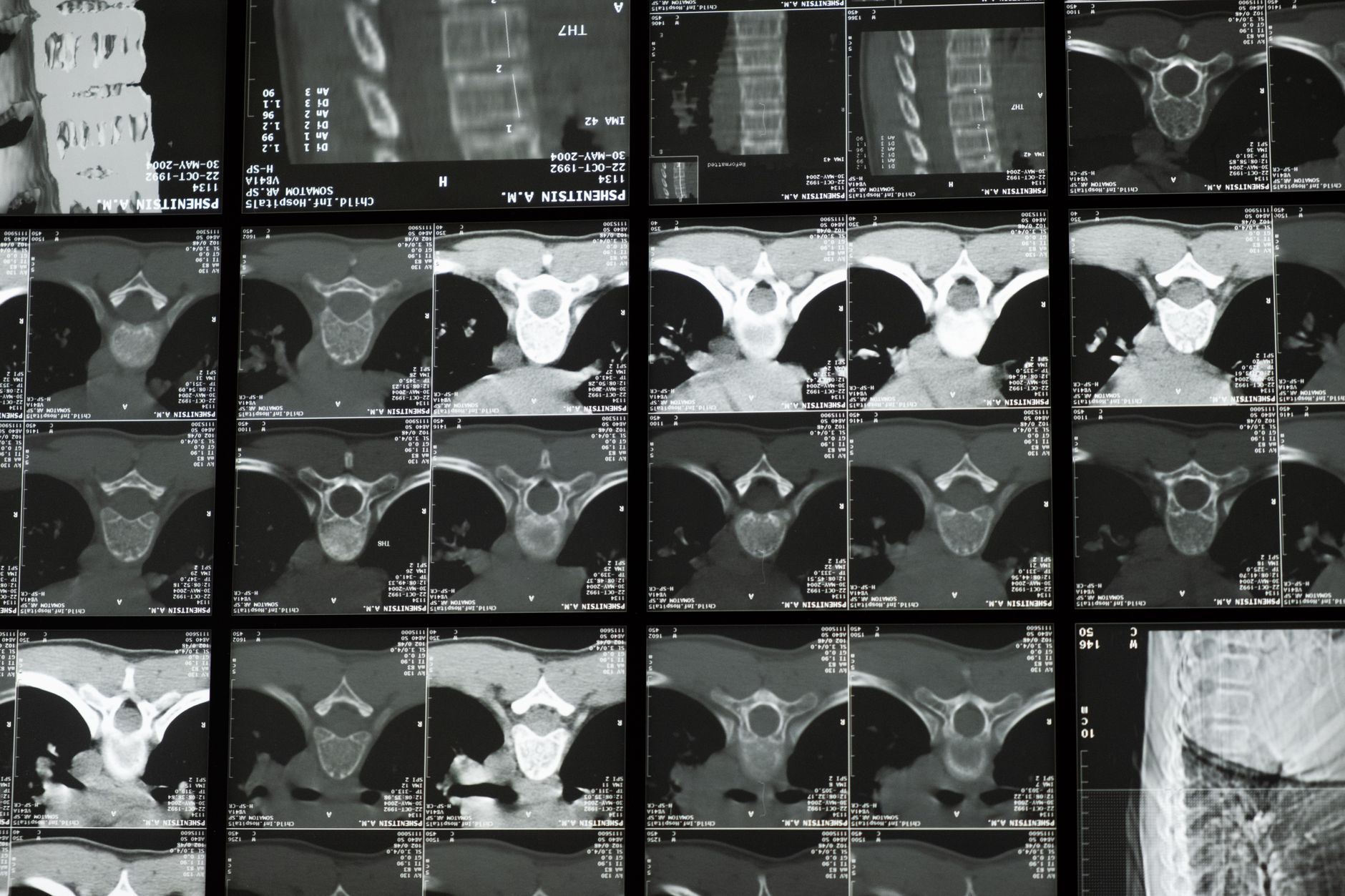Teledyne's Strategic Acquisition of Varex Imaging for $1.1 Billion