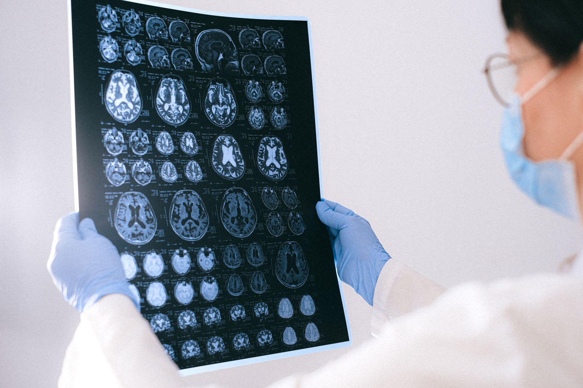Revolutionising Neuroimaging: Harnessing Health System Learning