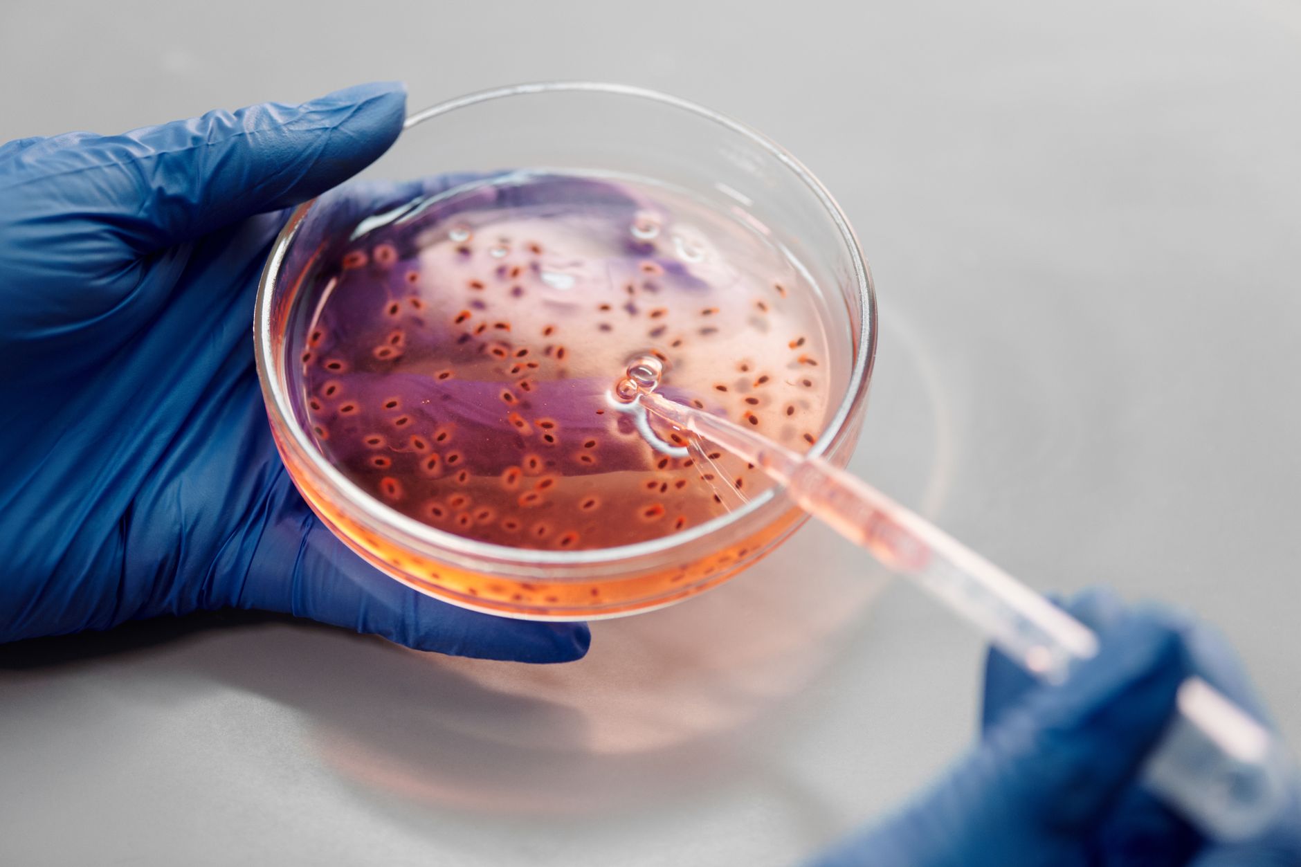Intriguing Virus Absconds with Human Gene, Refuses to Relinquish