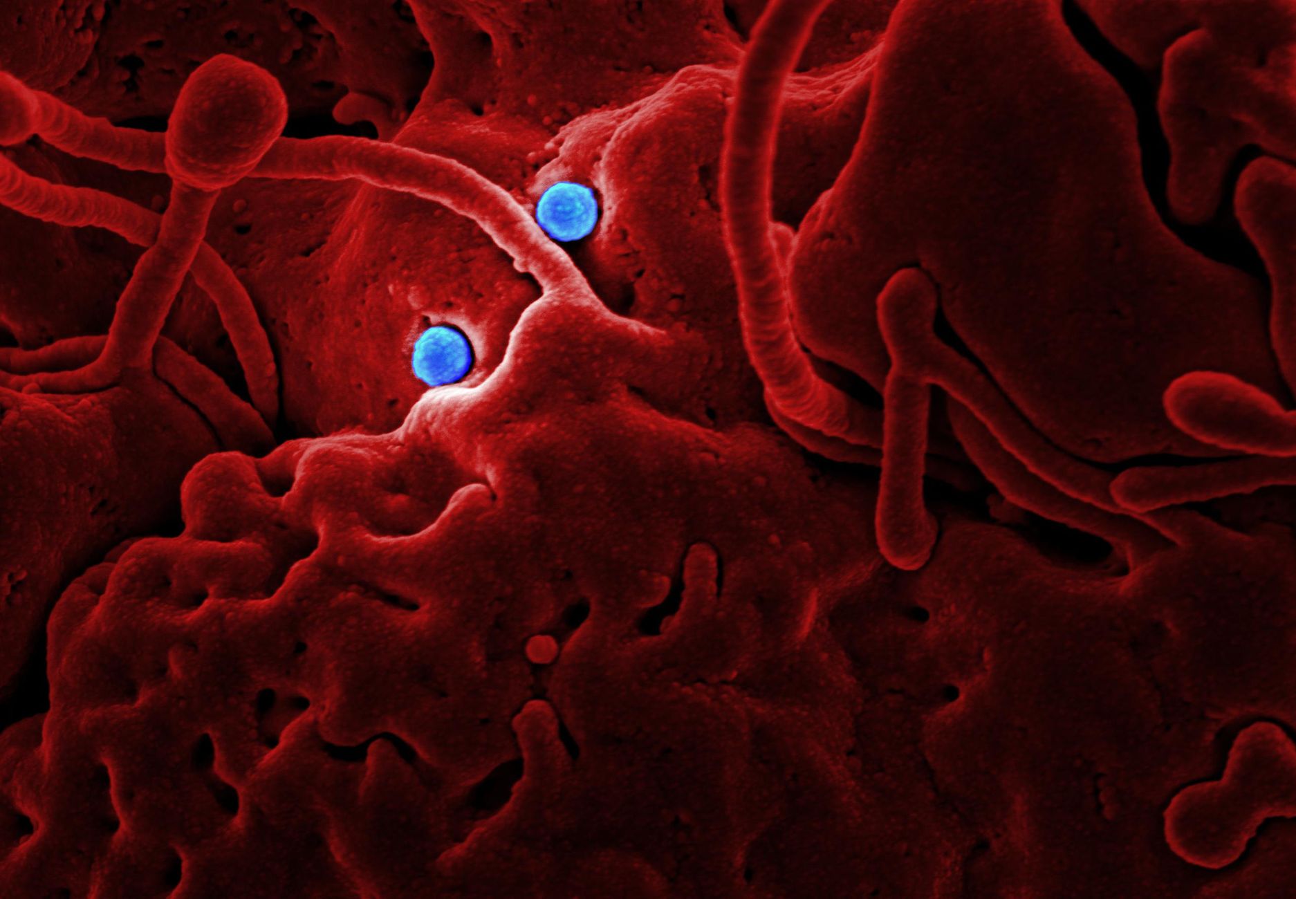 Unveiling the Thymus: New Insights into Myasthenia Gravis