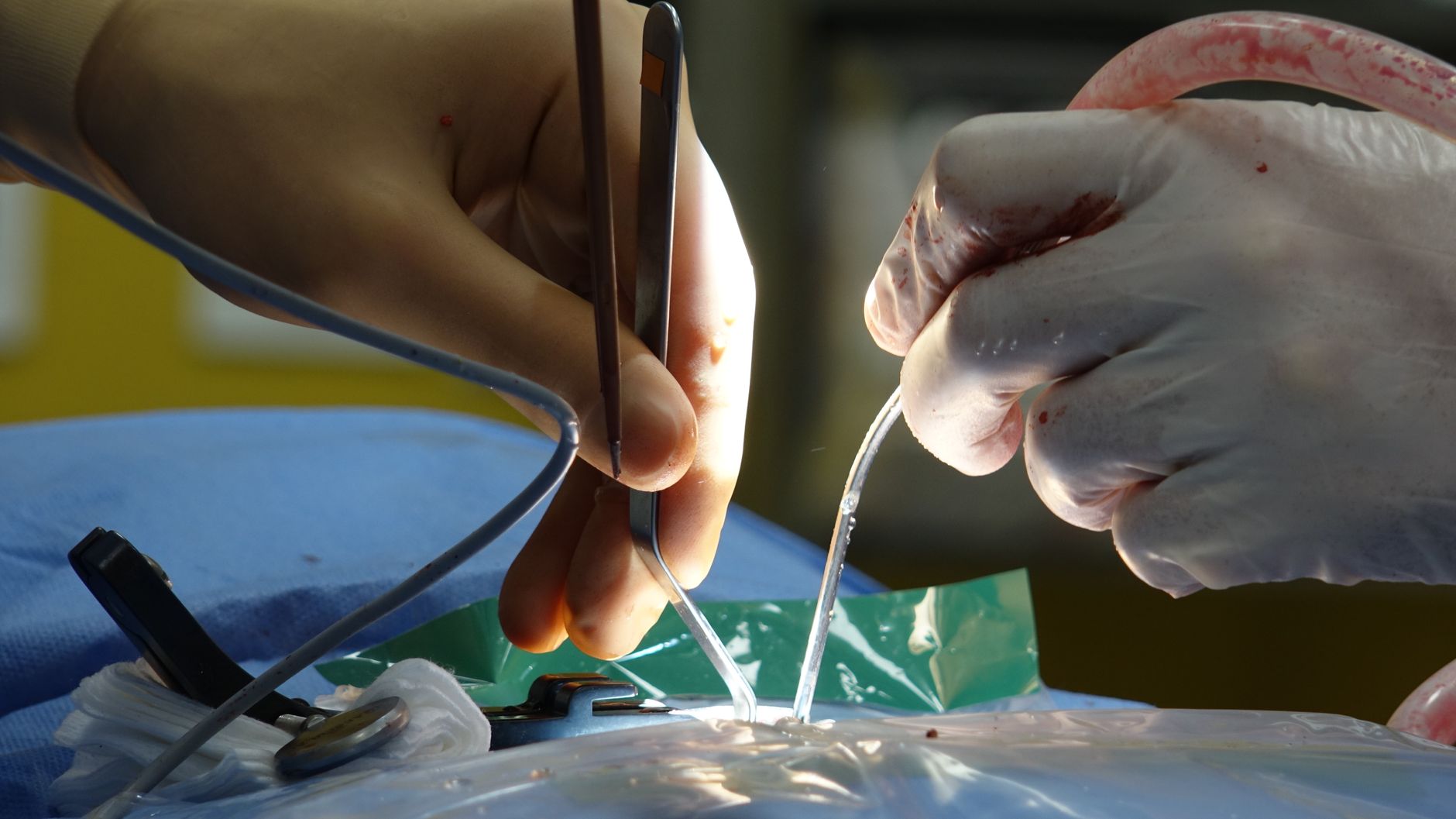 Breakthrough in Nerve Repair: Scientists Uncover Protein Barrier