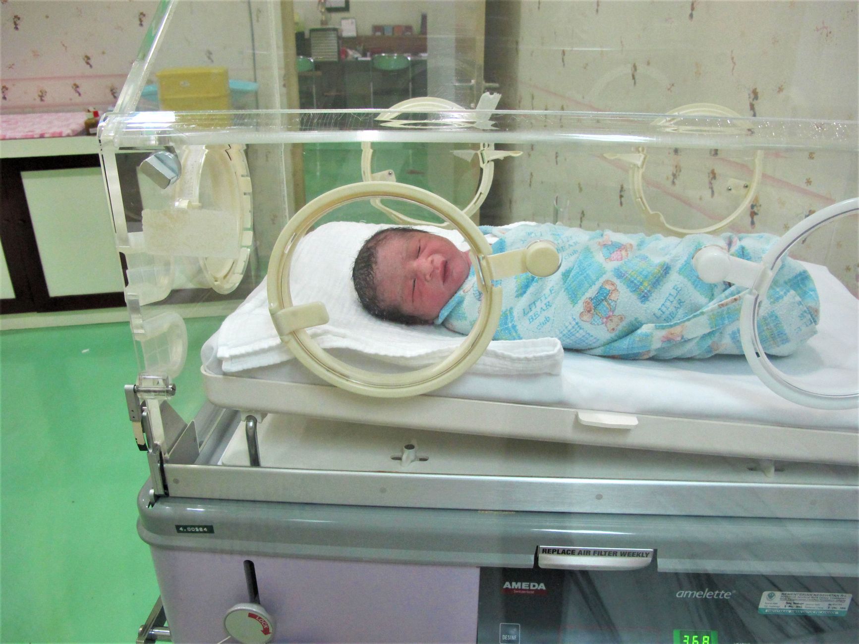 Innovative Tool Enhances Premature Newborn Care in India