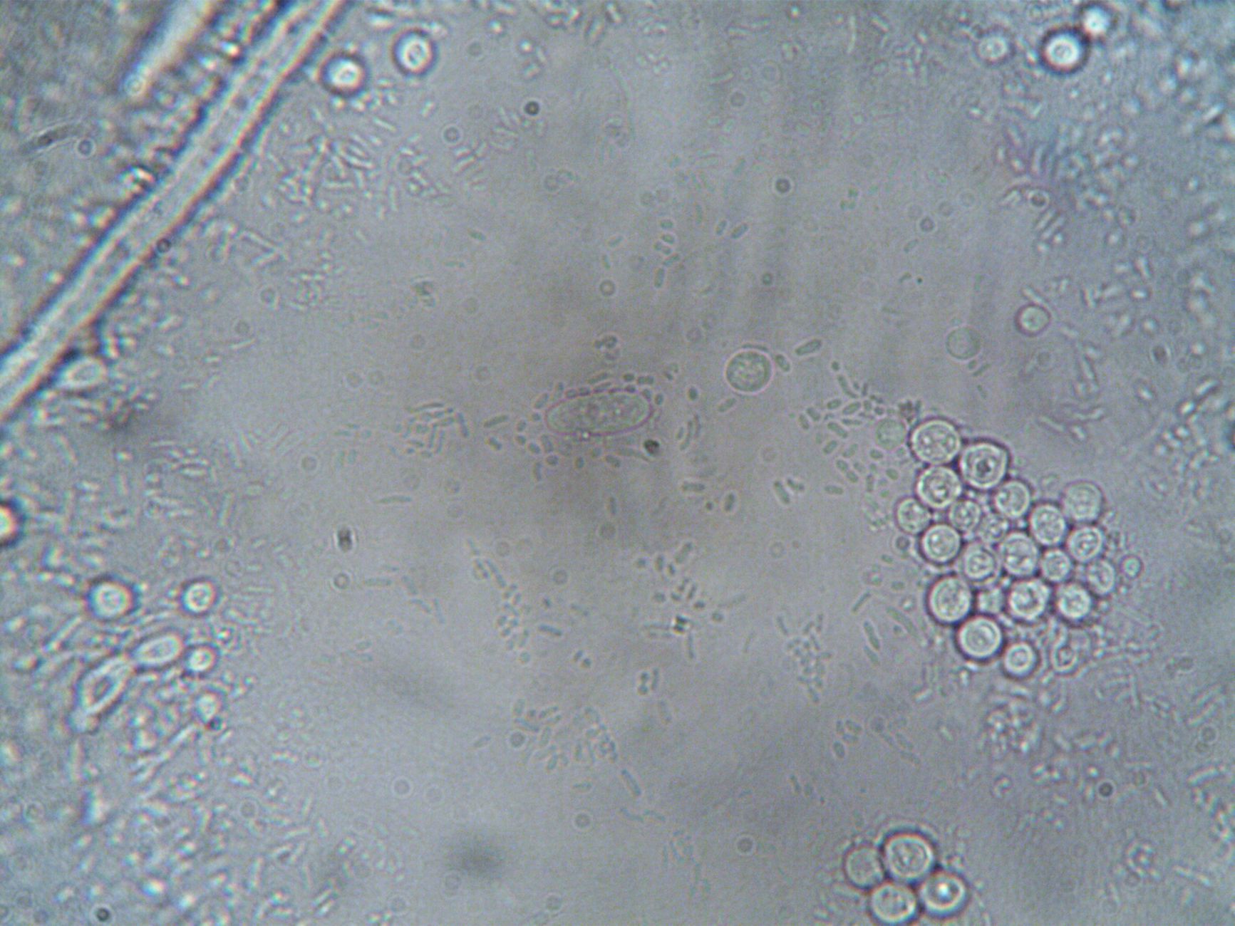 The Cellular Secret Behind Enlarging Prostates Unveiled