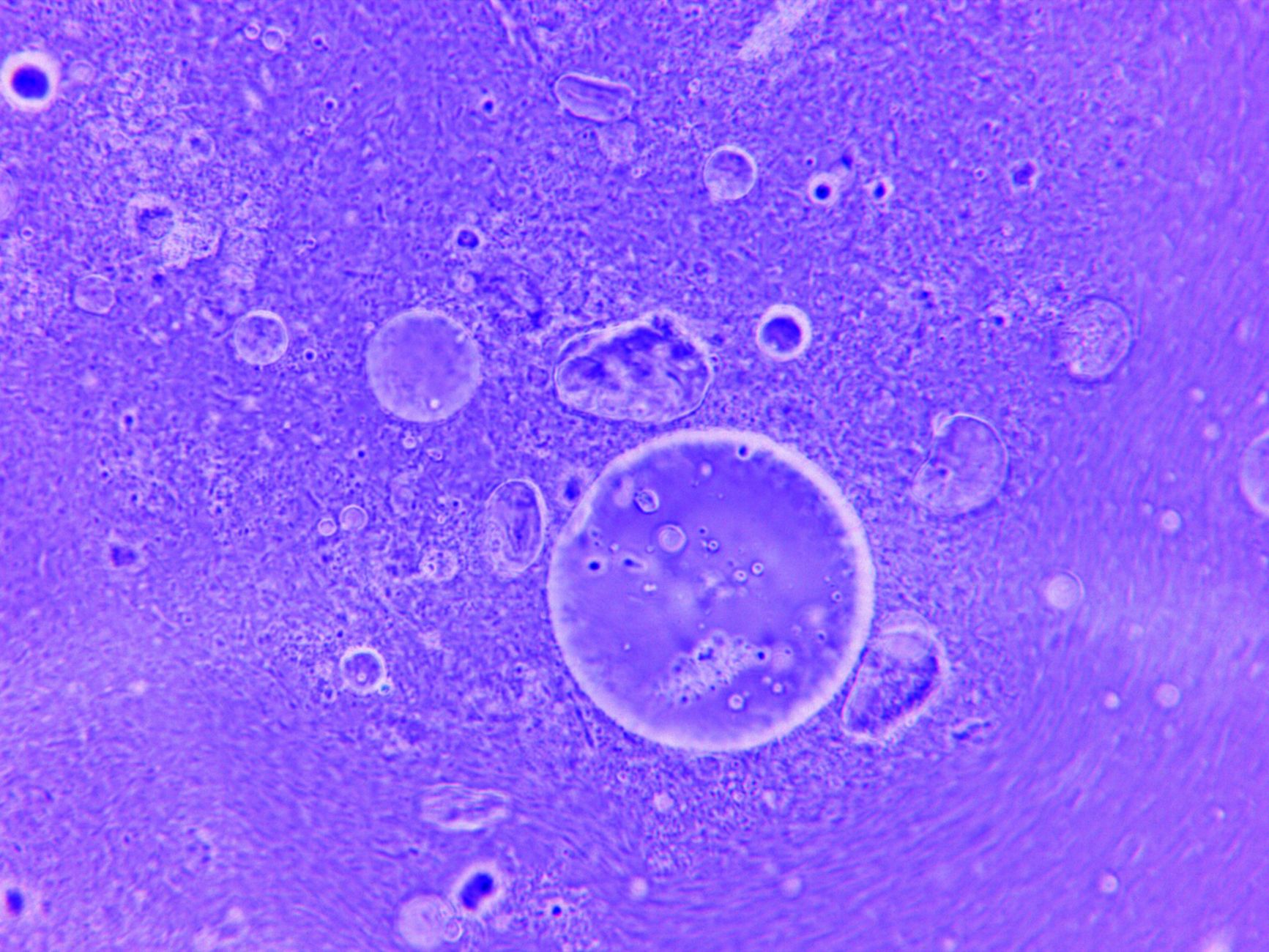 Scientists Unveil Collagen's Liquid State Within Cells