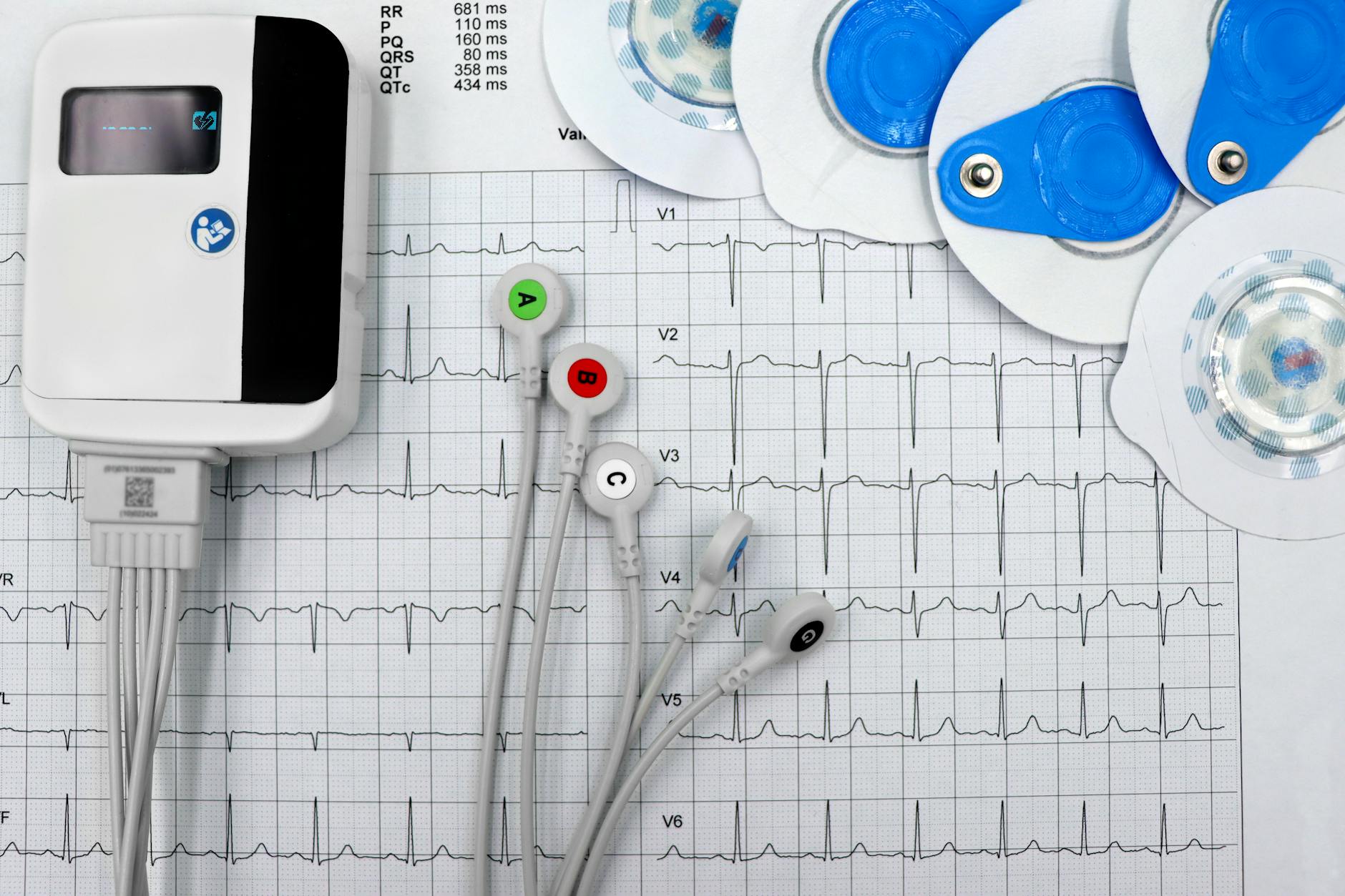 Smartphones Poised to Revolutionise Heart Monitoring Globally