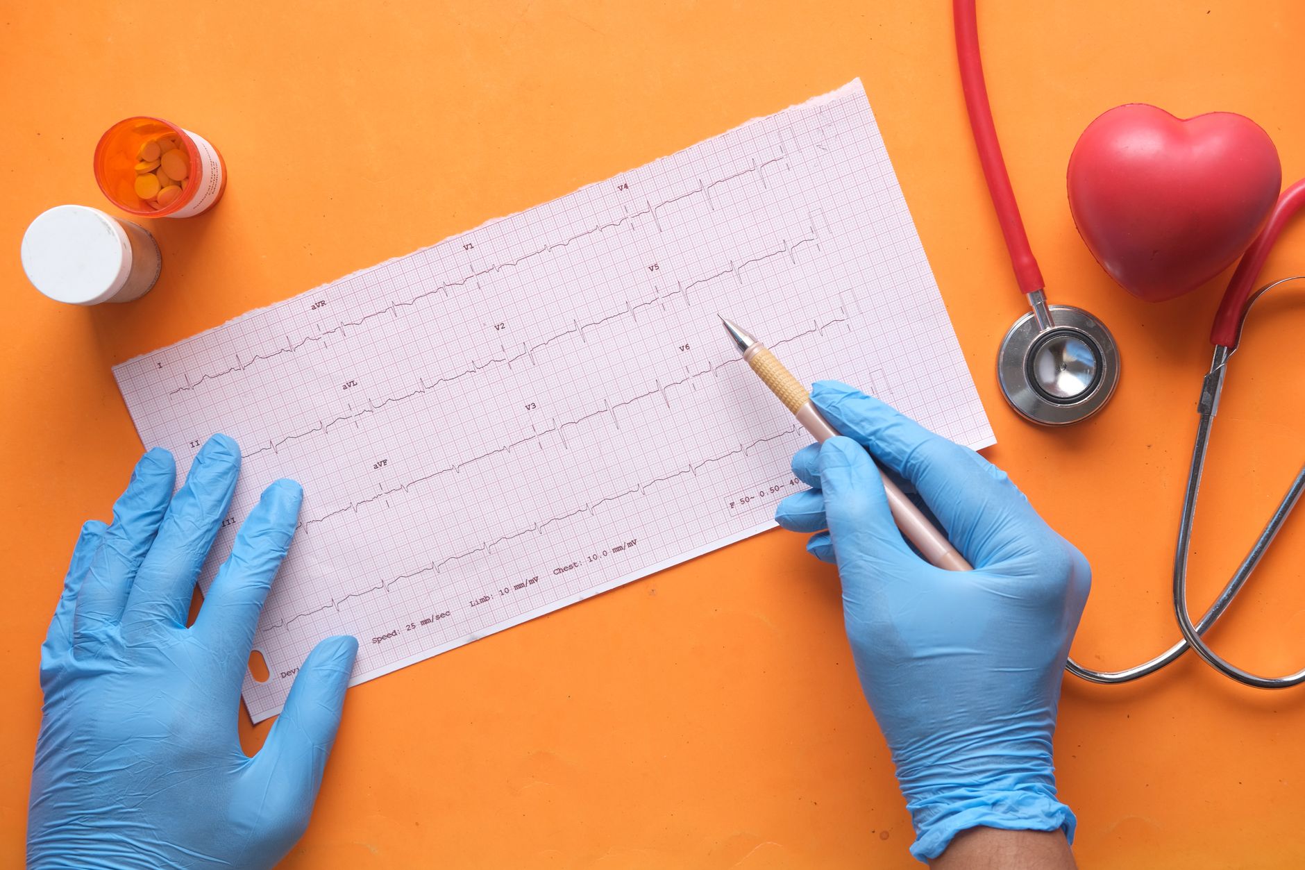 Understanding Heart Health: Risks and Prevention