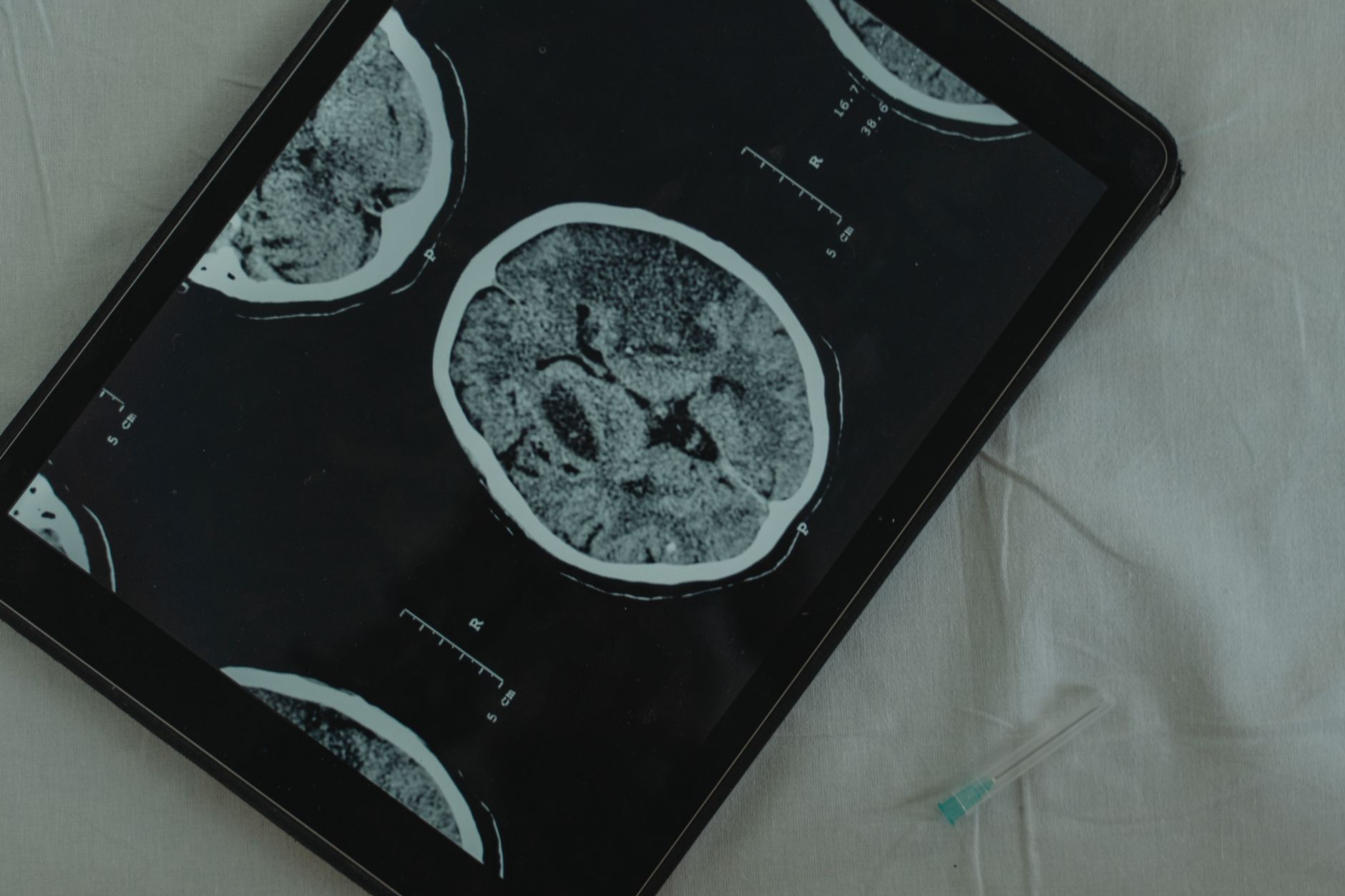 The Maternal Cells That May Reside in Your Brain for Decades